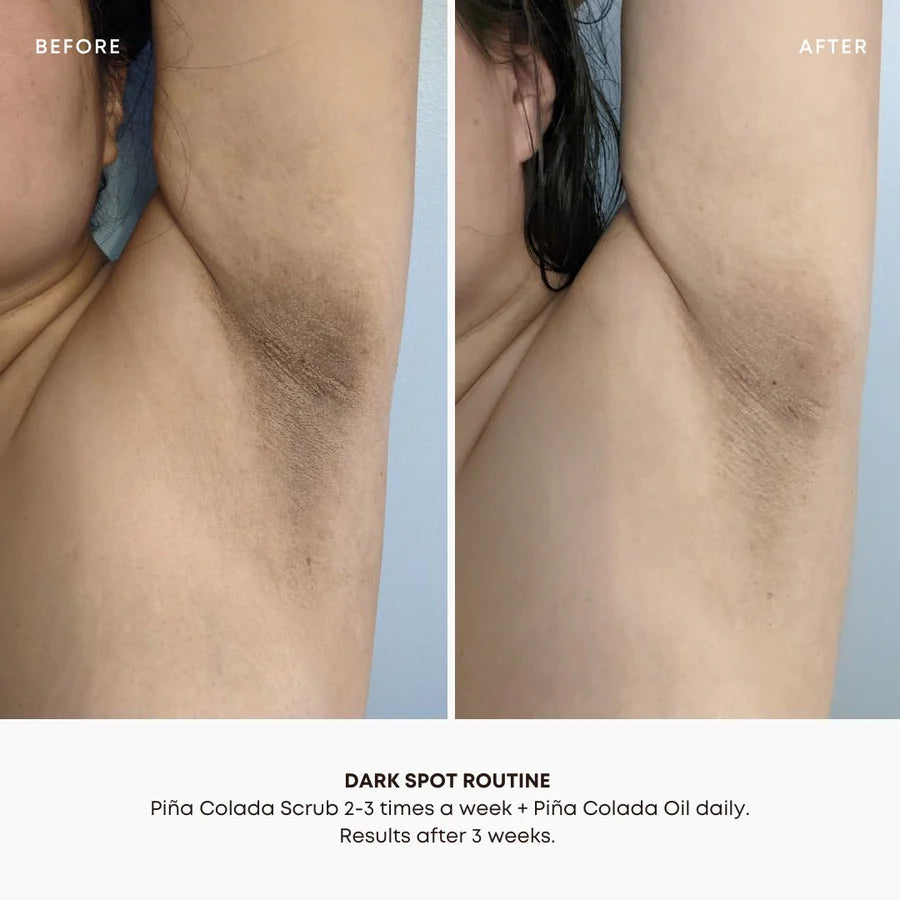 Dark Spot Oil Pina Colada