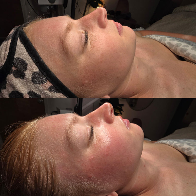 Before and after: brighter, glowing skin after a facial at Oregon Glow in Junction City, OR
