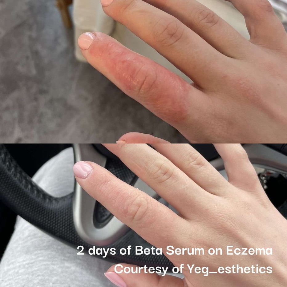 Neogenesis Beta Glucan Serum