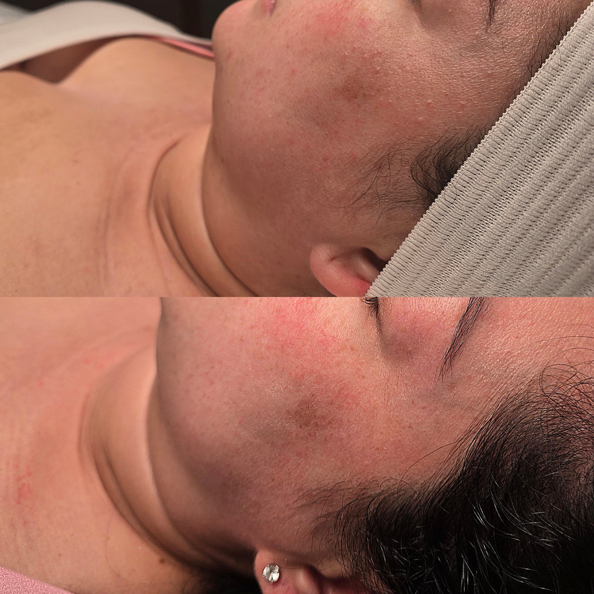 Before and after: a faded dark spot and more even tone at Oregon Glow in Junction City, OR