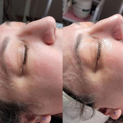 Winter Collagen + DMK Renewal Package