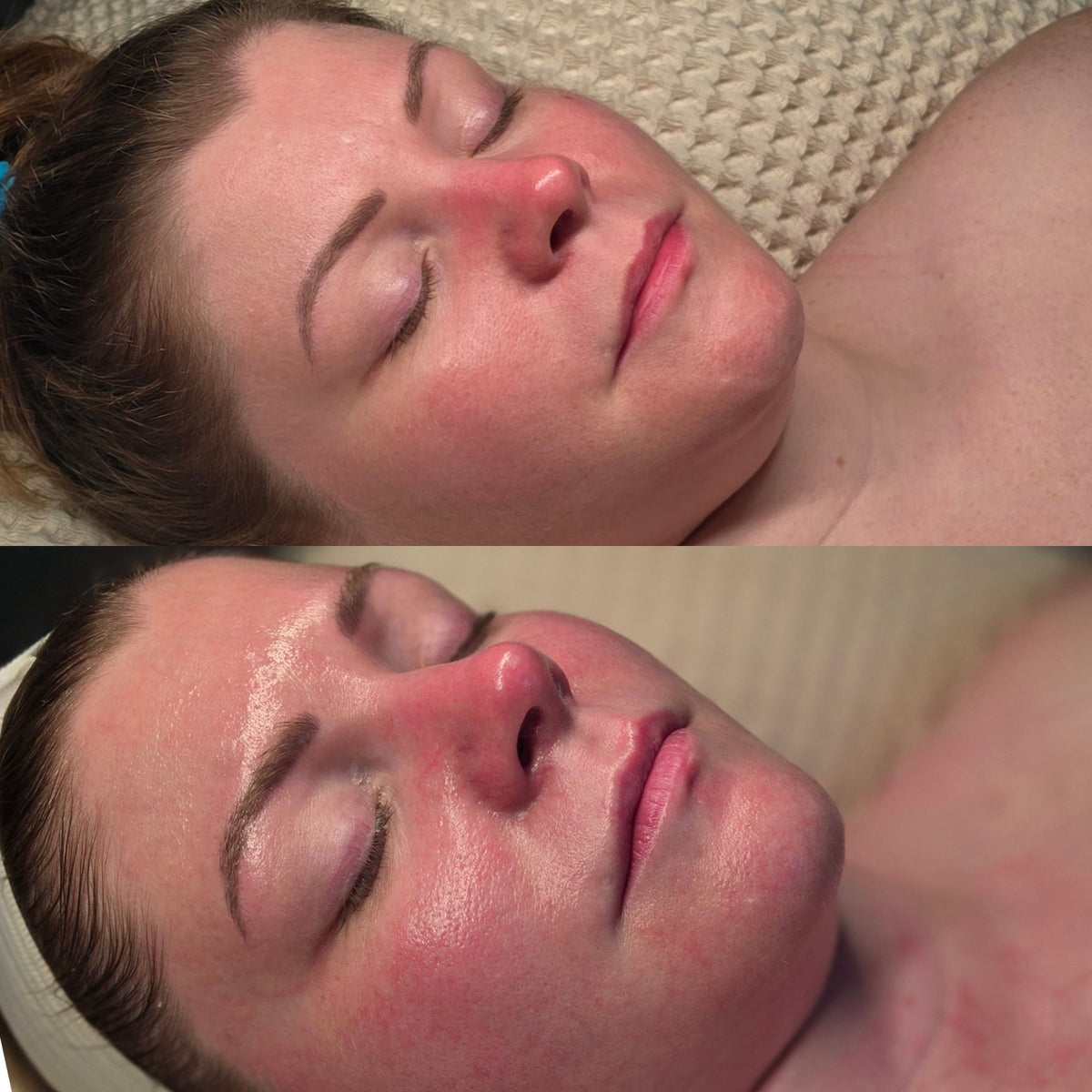 Before and after: redness and texture after an advanced facial at Oregon Glow in Junction City, OR