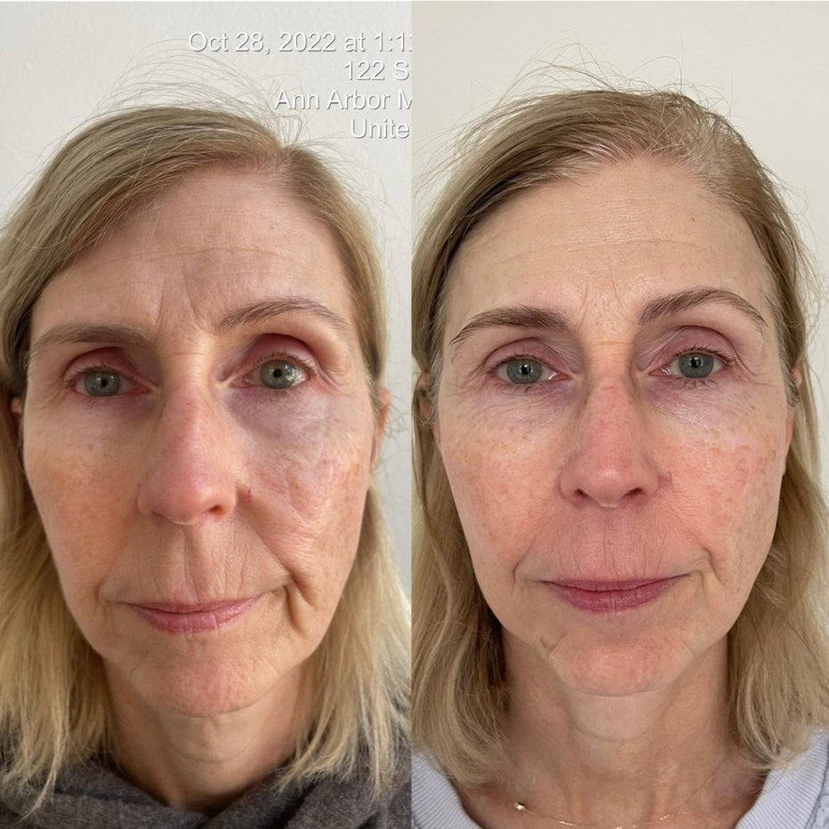 KrX Youthplex Toning Solution