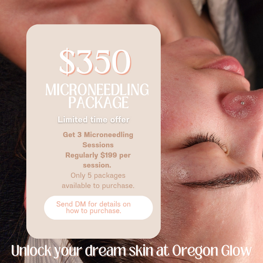 Package of 3 microneedling sessions Sale